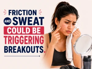 Friction and Sweat Could Be Triggering Breakouts