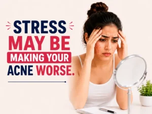Stress May Be Making Your Acne Worse